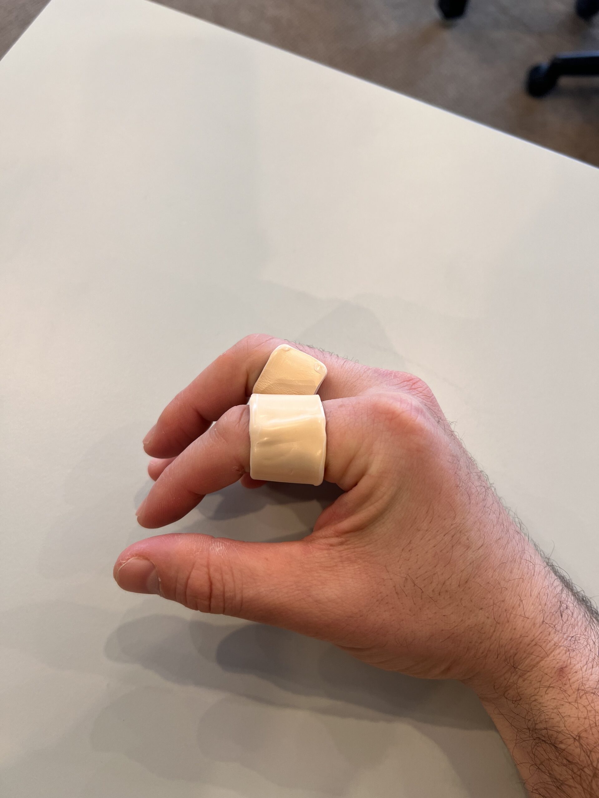 IMG_5806 Finger Injury