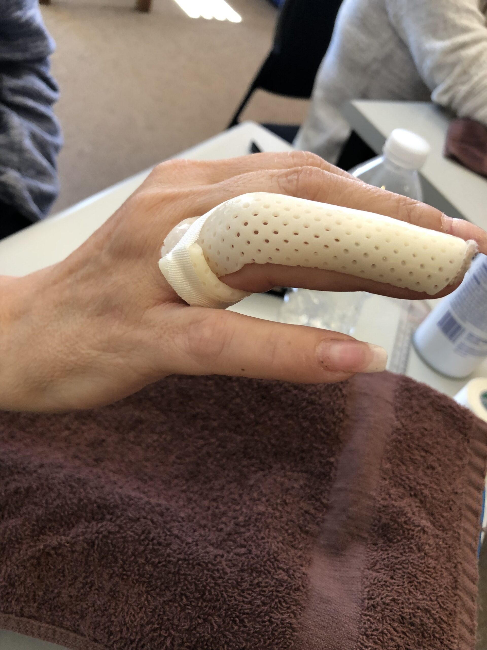 IMG_9077 Hand Injury
