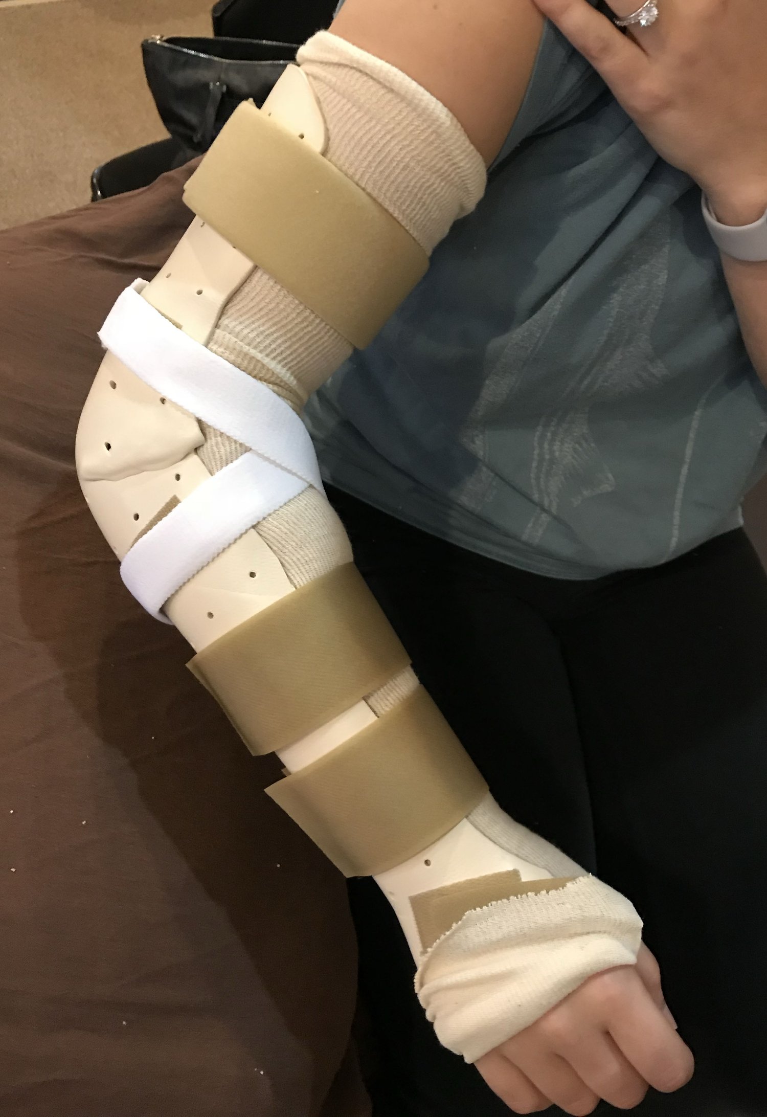 full+arm+vertical Full Arm Vertical Cast