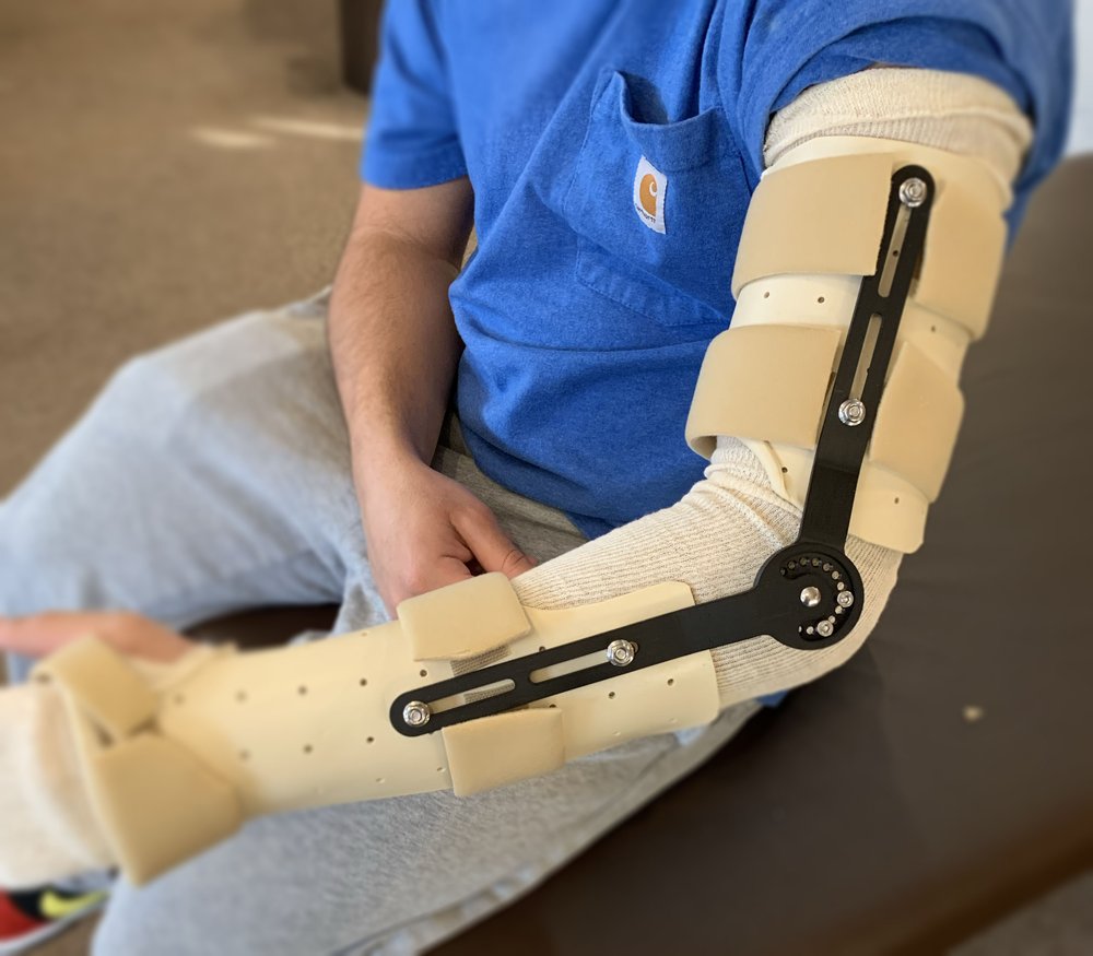 full+left+arm+and+hand+mechanism Arm Mechanism