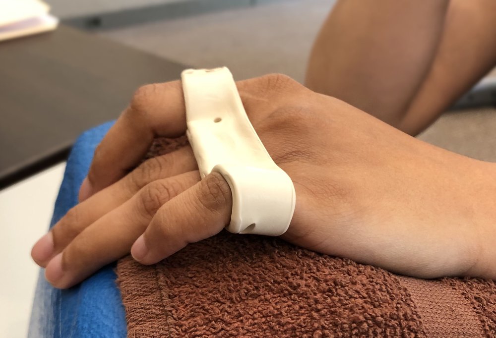 left+hand+across+knuckle Knuckle Cast