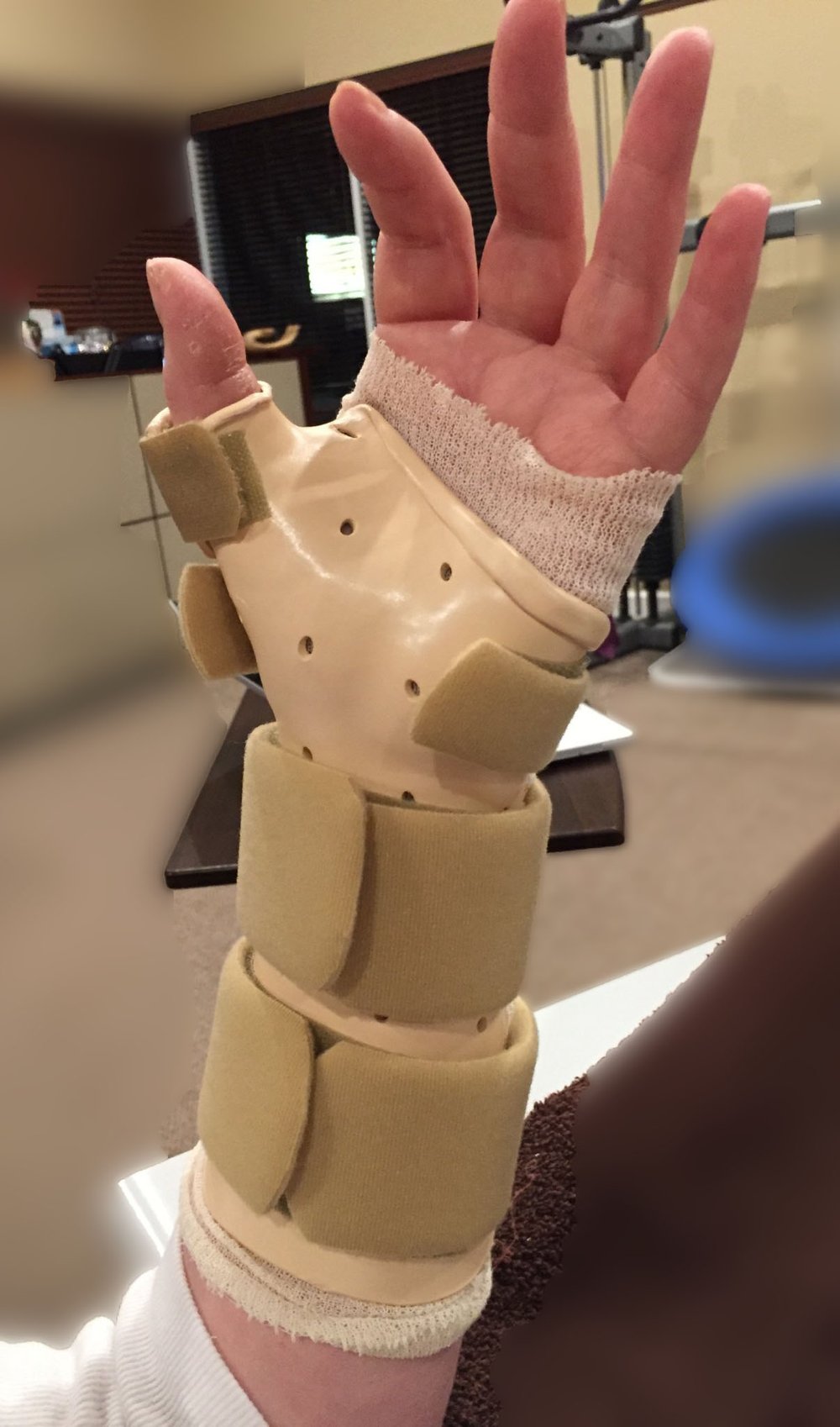 left+hand+and+arm+vertical Hand Cast